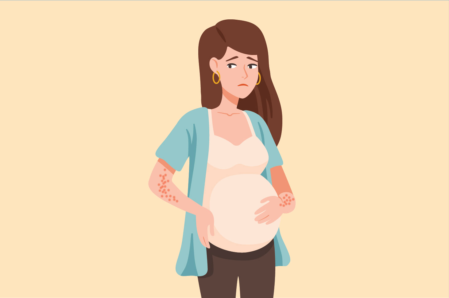 Беременные женщины могут испытывать крапивницу, знайте причину
