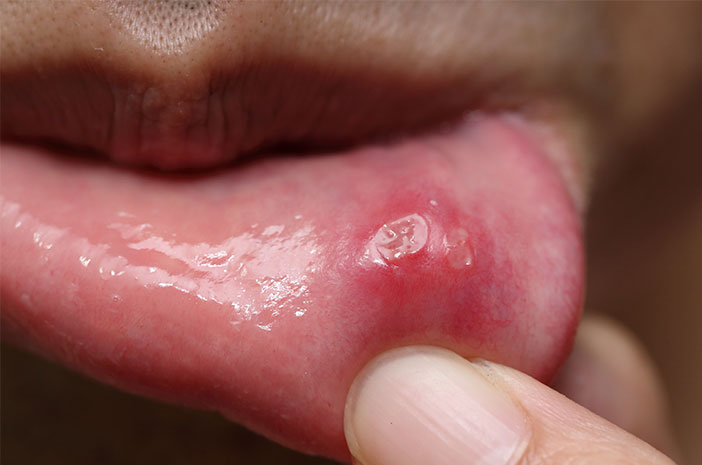Acestea sunt 5 tulburări comune de sănătate orală