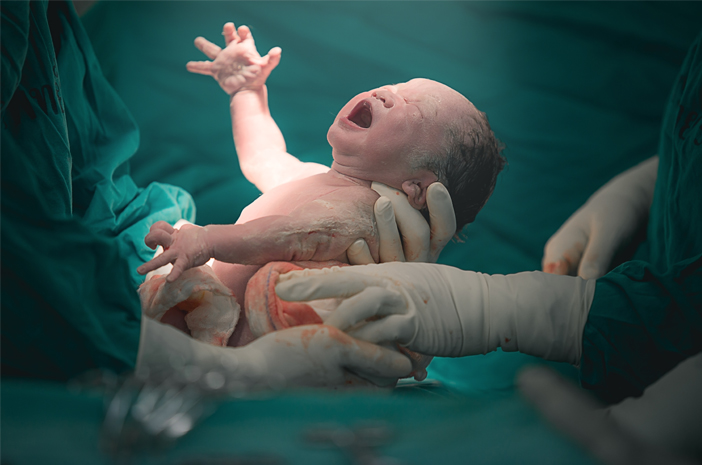 Les nouveau-nés peuvent-ils vraiment contracter le syndrome de Horner ?