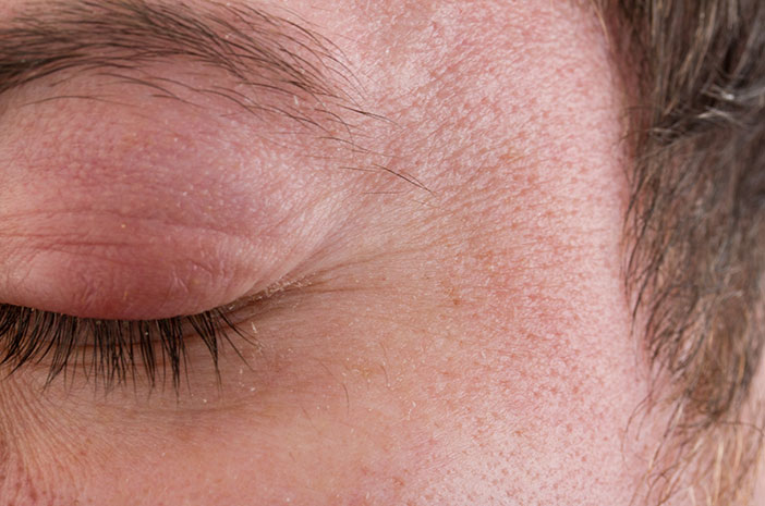 הכירו את טרכומה, המחלה שגורמת לעיוורון הגבוה ביותר באפריקה