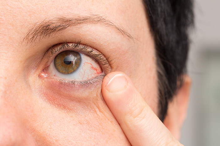 Upoznajte uzroke ablacije retine