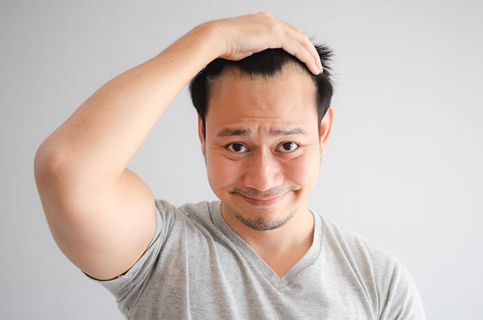 Verhindern Sie Kahlheit, so können Sie Haarausfall überwinden