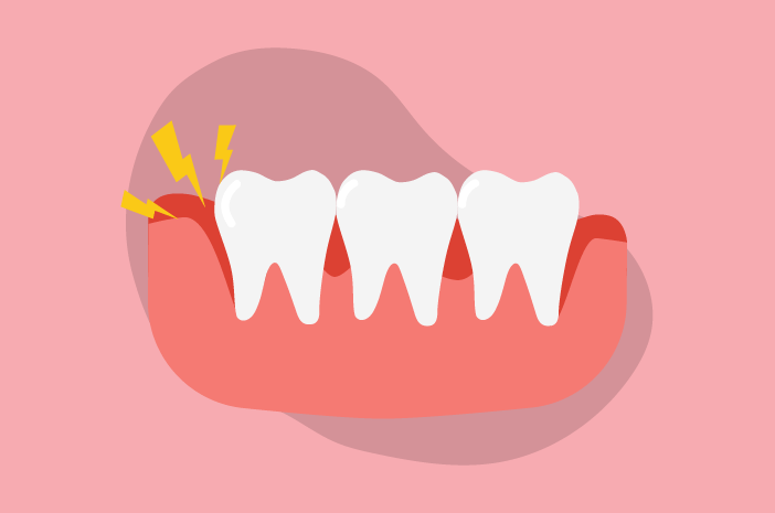 5 vanor som kan utlösa inflammerat tandkött