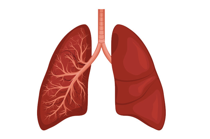 3 폐의 고름의 원인인 농흉 치료
