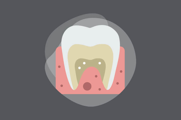 Beneficios de los dientes panorámicos para el tratamiento de ortodoncia (frenillos)