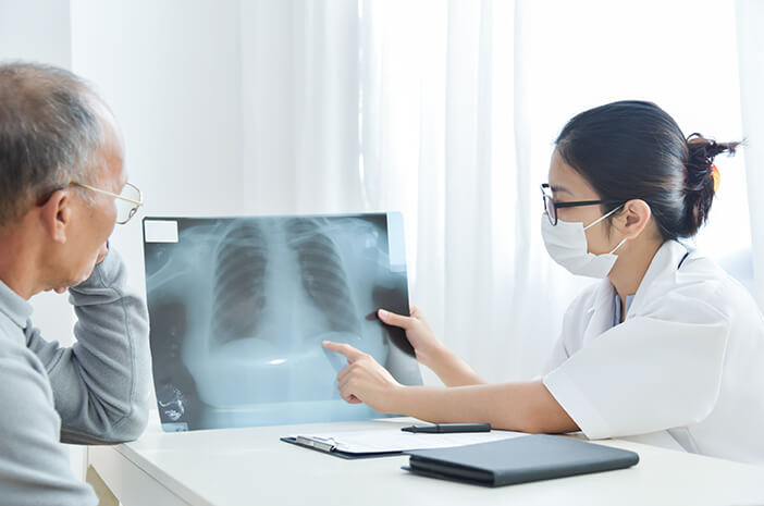 Mesures médicales prises pour vaincre le cancer du poumon