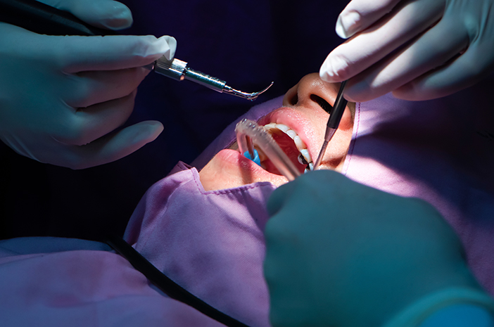 Combien de temps faut-il pour détartrer une dent chez un dentiste ?
