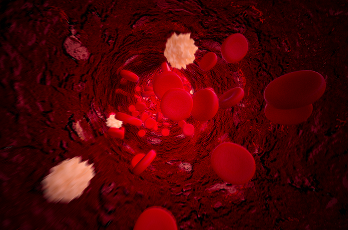 Les plaquettes dans le sang élevé peuvent être une maladie